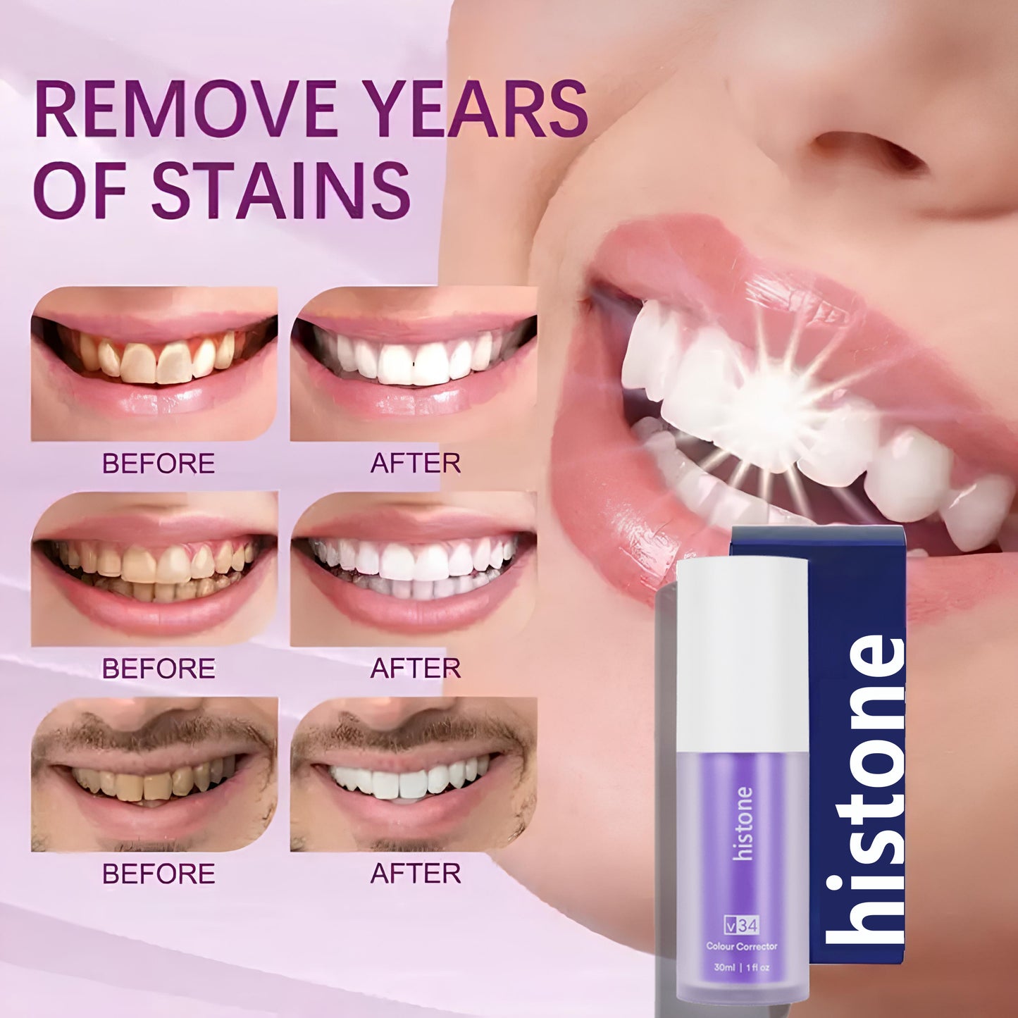 Histone™  V34 Colour Corrector Serum